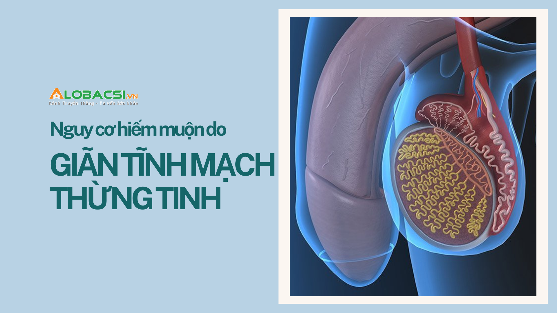 Giãn tĩnh mạch thừng tinh chiếm 80% nguyên nhân vô sinh thứ phát