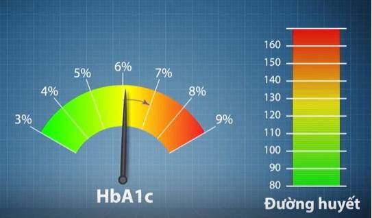 Top 5 thắc mắc về mối quan hệ giữa bệnh tiểu đường và đột quỵ