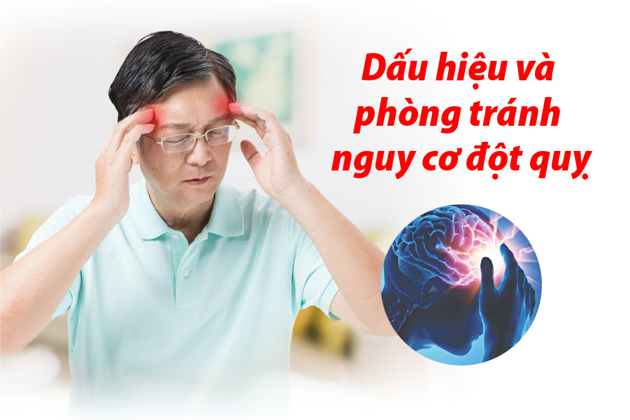 4 bước dự phòng đột quỵ hiệu quả