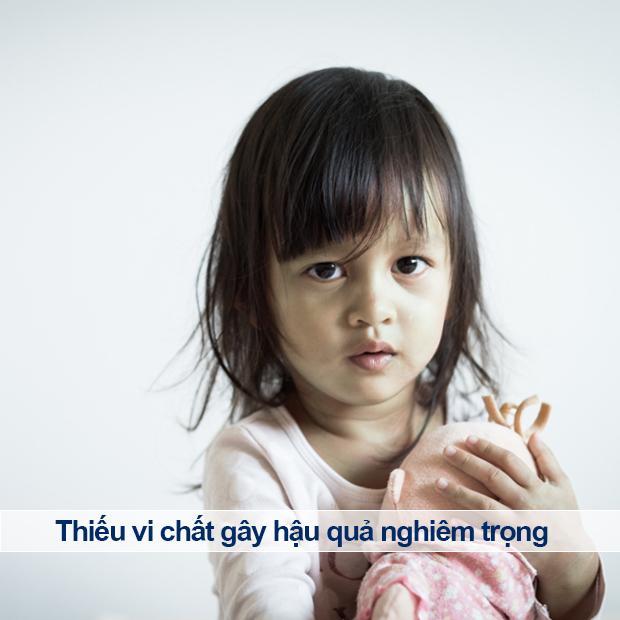 Bổ sung vitamin D3 đúng cách, cho con chiều cao tối ưu