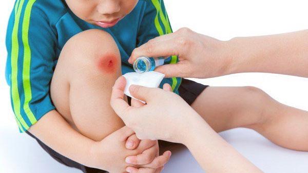 Serum ZACAMYCIN - Giải pháp điều trị vết thương, lở loét, mụn nhọt hiệu quả